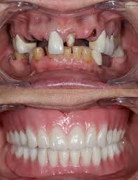 Fully equipped dental operatory used for full mouth rehabilitation