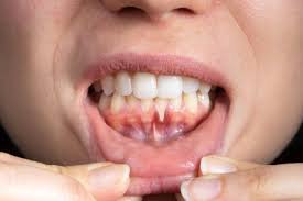 Dental surgeon checking a patient's gums for signs of gum disease